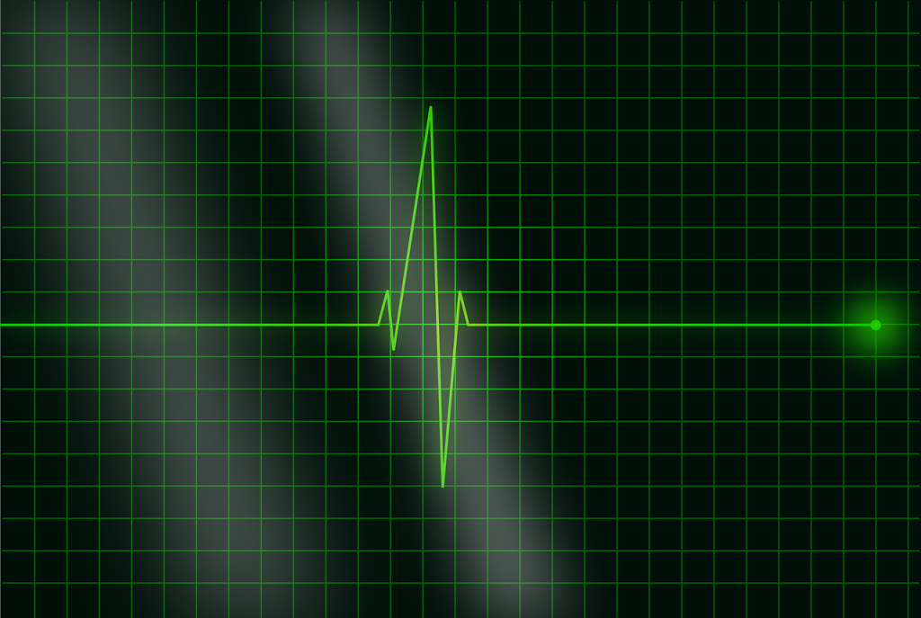 electrocardiogram, ecg, heartbeat-36732.jpg
